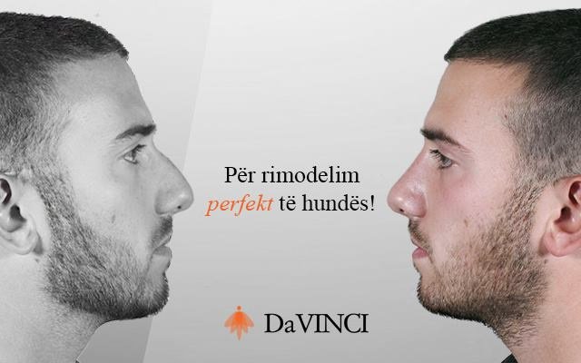 Servizi di Chirurgia Plastica e medicina estetica Prishtinë Kosovë