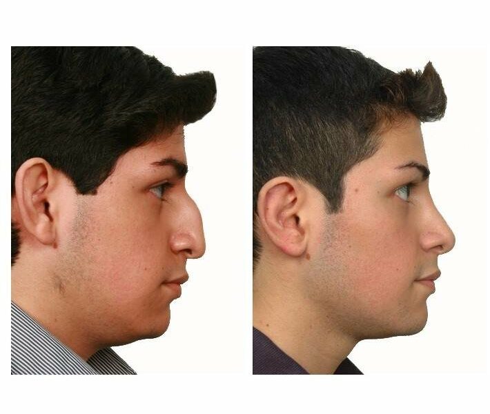 Servizi di Chirurgia Plastica e medicina estetica Prishtinë Kosovë
