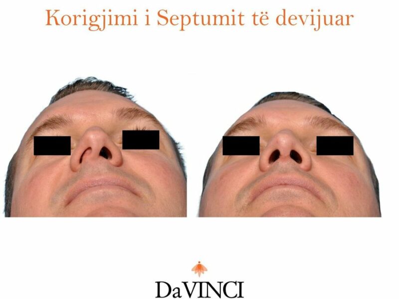 Servizi di Chirurgia Plastica e medicina estetica Prishtinë Kosovë