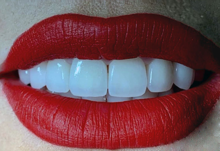 Dentisti in Albania - Union Dental Clinic Tirana