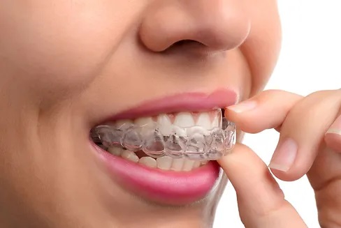 Dentisti in Albania - Union Dental Clinic Tirana