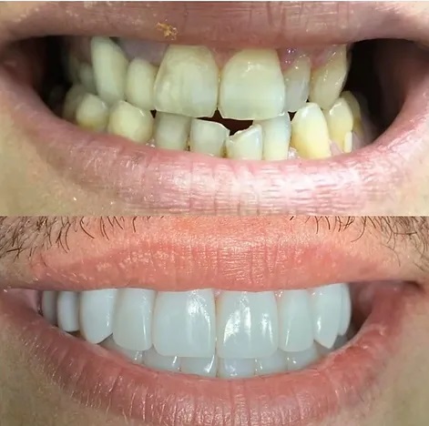 Dentisti in Albania - Union Dental Clinic Tirana