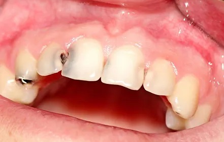 Dentisti in Albania - Union Dental Clinic Tirana