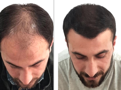 Servizi di Chirurgia Plastica e Medicina Estetica