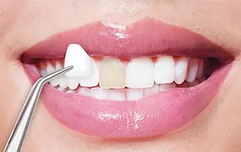 Dentisti in Albania - Union Dental Clinic Tirana